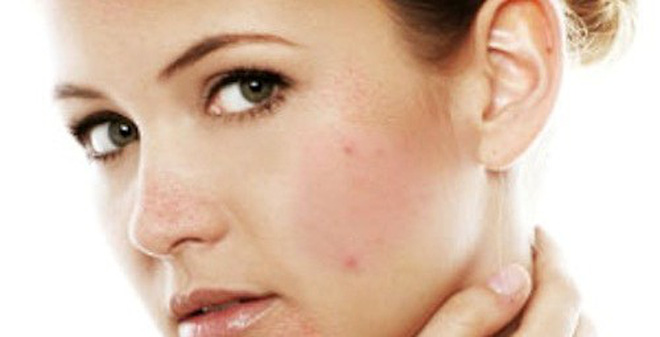 chống lão hóa cho da nhạy cảm