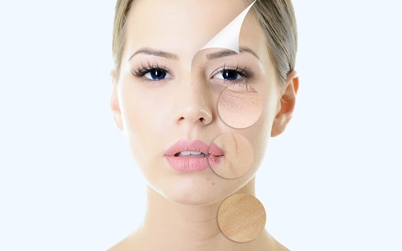 nâng cơ mặt không cần phẫu thuật