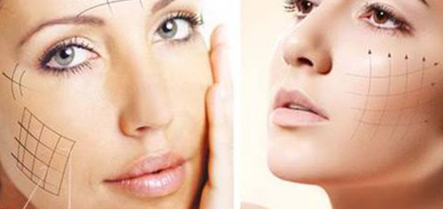 nâng cơ tự nhiên